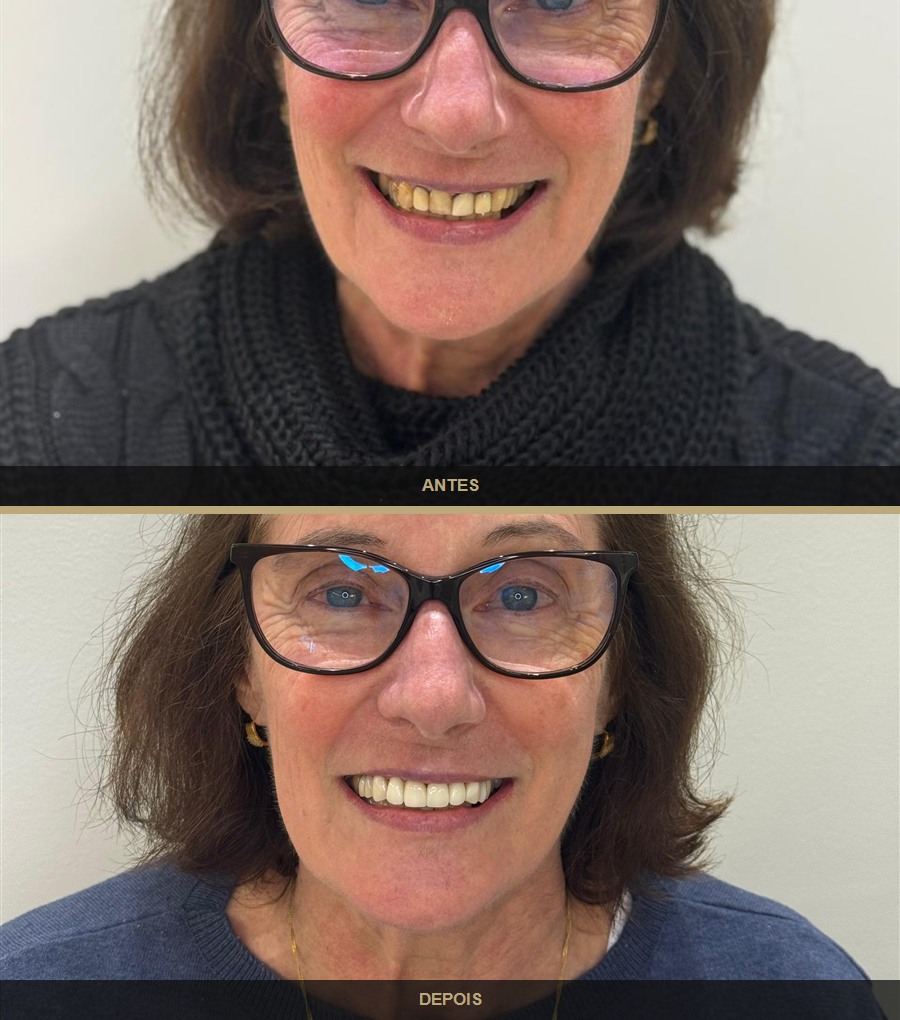 Antes e depois — caso 1