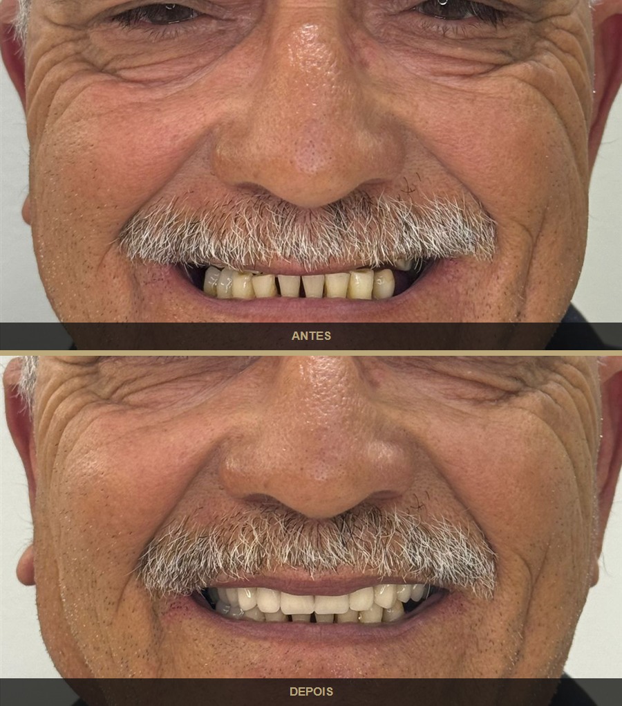Antes e depois — caso 2