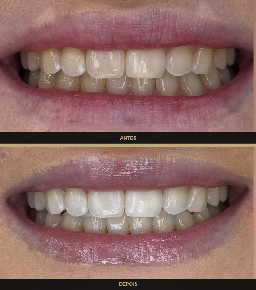 Antes e depois — caso 3