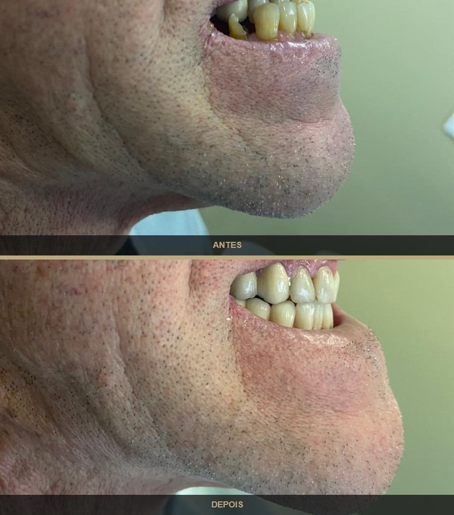Antes e depois — caso 7