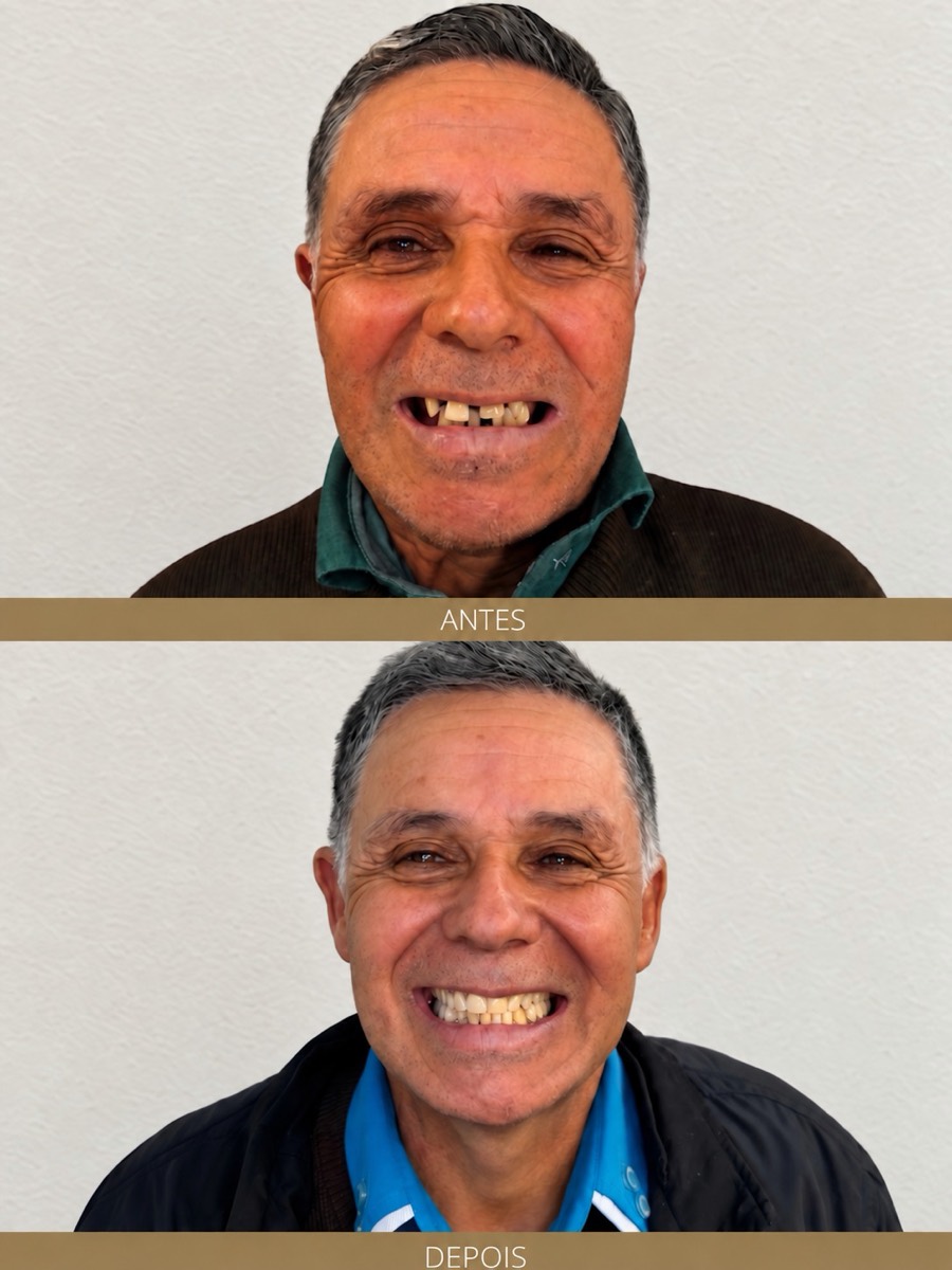 Antes e depois — depoimento